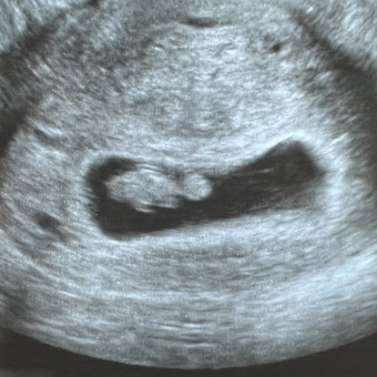 Babylist Registry Photo.