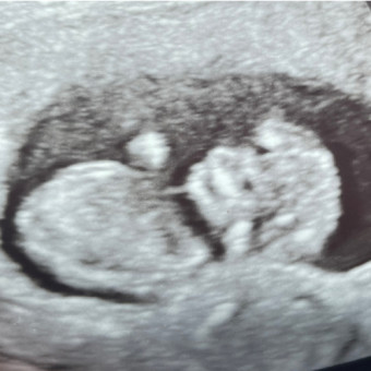 Babylist Registry Photo.