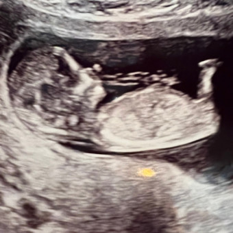 Babylist Registry Photo.