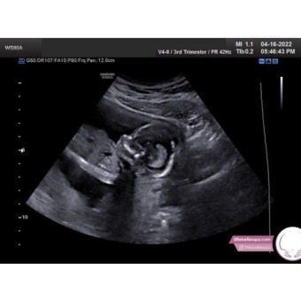 Babylist Registry Photo.