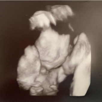 Babylist Registry Photo.