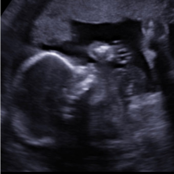 Babylist Registry Photo.