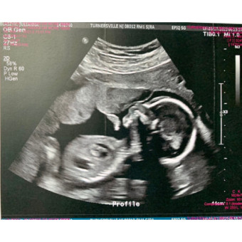 Babylist Registry Photo.