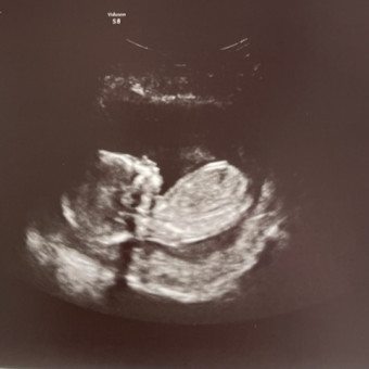 Babylist Registry Photo.