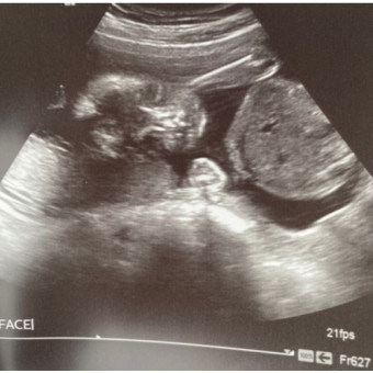 Babylist Registry Photo.