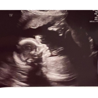 Babylist Registry Photo.