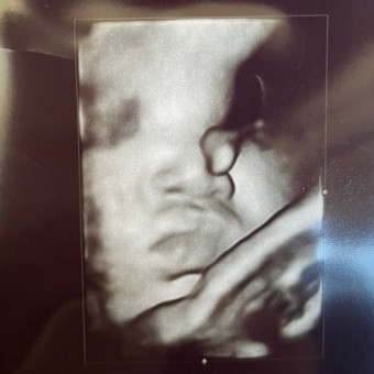 Babylist Registry Photo.