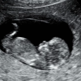 Babylist Registry Photo.