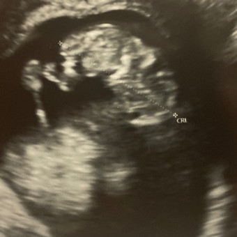 Babylist Registry Photo.