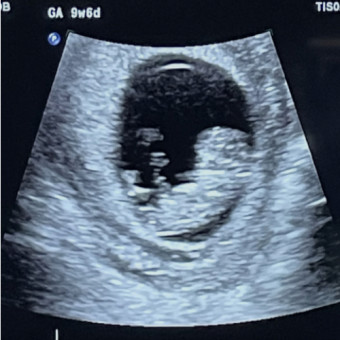 Babylist Registry Photo.