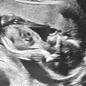 Babylist Registry Photo.