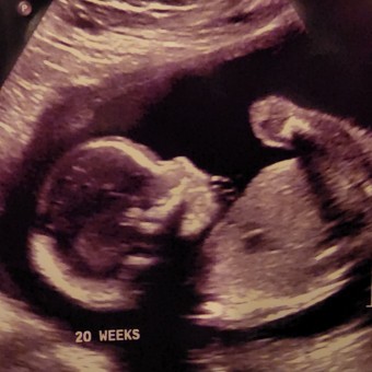 Babylist Registry Photo.