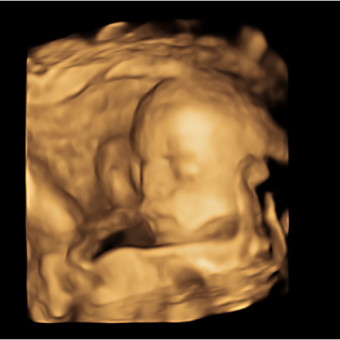 Babylist Registry Photo.