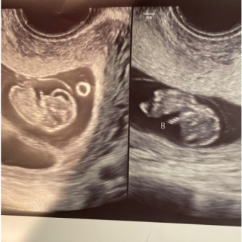 Babylist Registry Photo.