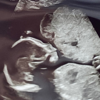 Babylist Registry Photo.