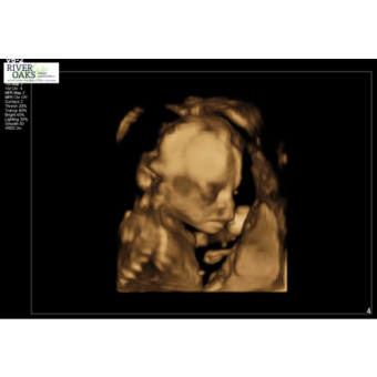 Babylist Registry Photo.