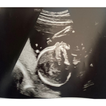 Babylist Registry Photo.