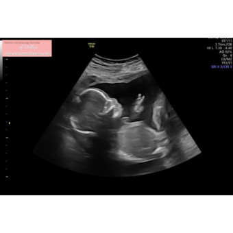 Babylist Registry Photo.