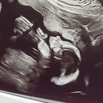 Babylist Registry Photo.