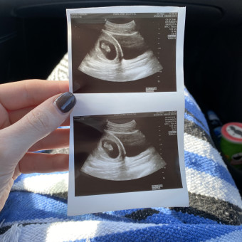 Babylist Registry Photo.