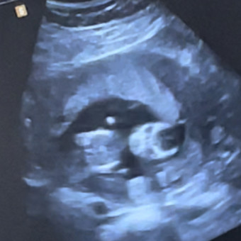Babylist Registry Photo.
