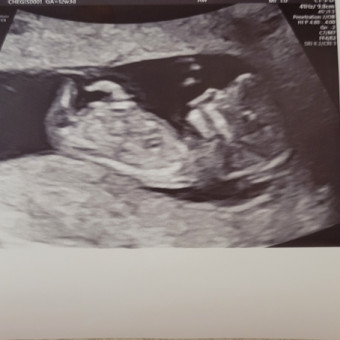Babylist Registry Photo.