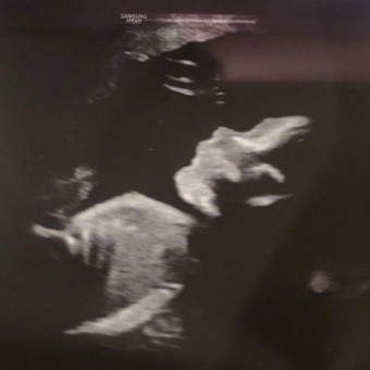 Babylist Registry Photo.