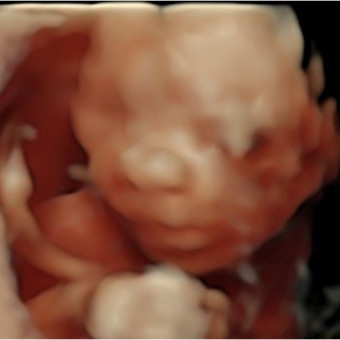 Babylist Registry Photo.