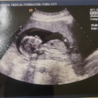 Babylist Registry Photo.