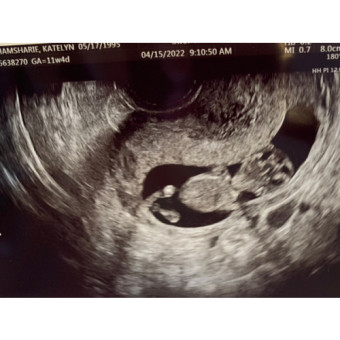 Babylist Registry Photo.