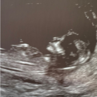 Babylist Registry Photo.