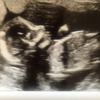 Babylist Registry Photo.