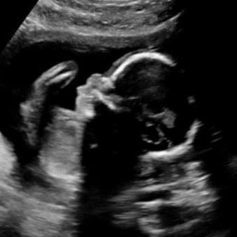Babylist Registry Photo.