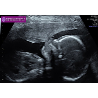 Babylist Registry Photo.