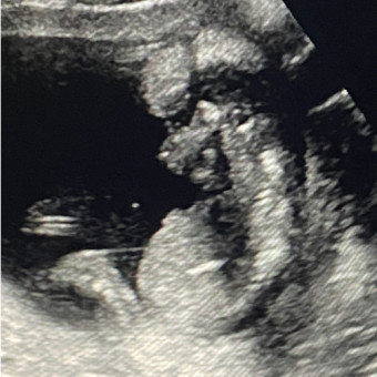 Babylist Registry Photo.