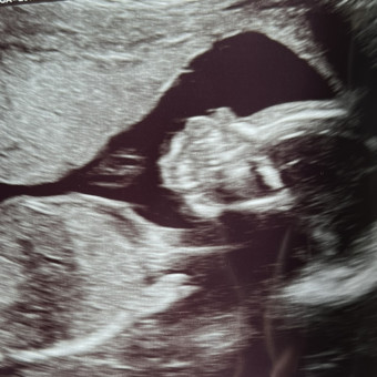 Babylist Registry Photo.