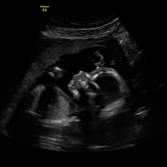 Babylist Registry Photo.