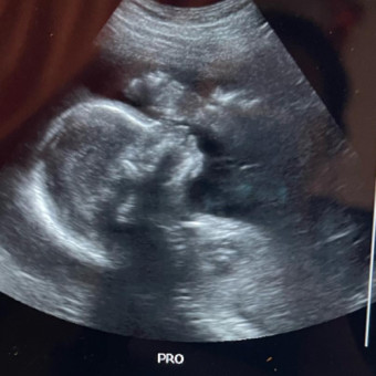 Babylist Registry Photo.