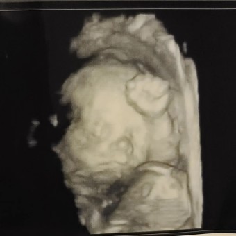 Babylist Registry Photo.