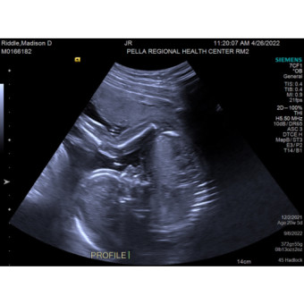 Babylist Registry Photo.