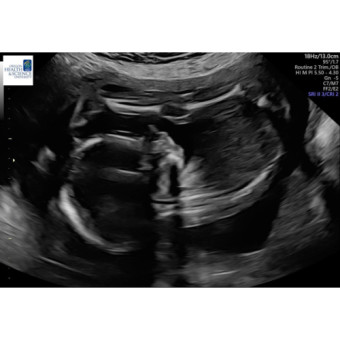 Babylist Registry Photo.