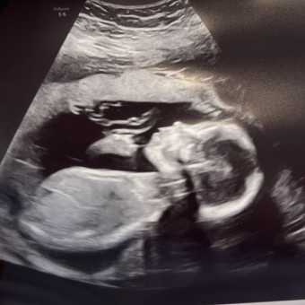 Babylist Registry Photo.