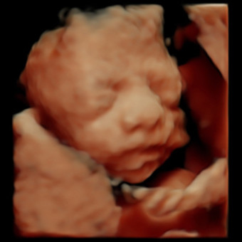 Babylist Registry Photo.