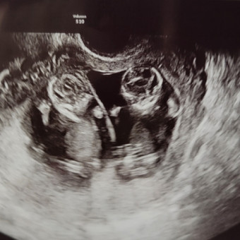 Babylist Registry Photo.