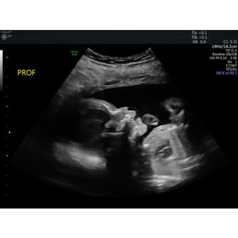 Babylist Registry Photo.