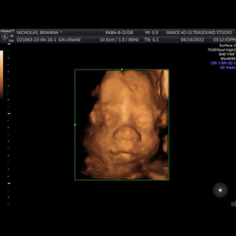 Babylist Registry Photo.
