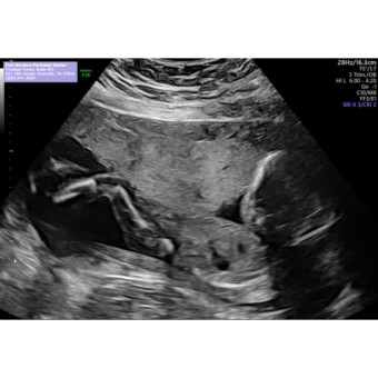 Babylist Registry Photo.