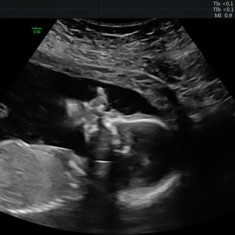 Babylist Registry Photo.