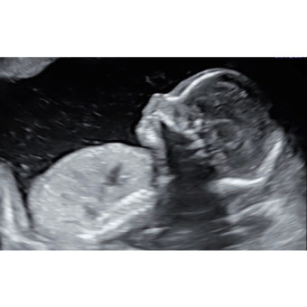 Babylist Registry Photo.