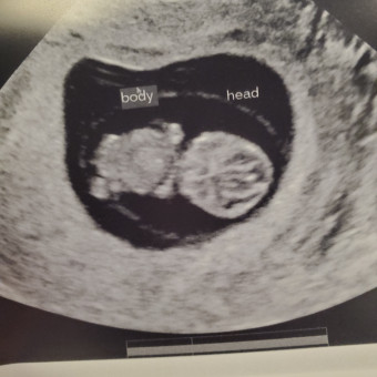 Babylist Registry Photo.